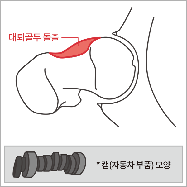 고관절